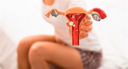Endometriosis: ¿Qué es y por qué da?
